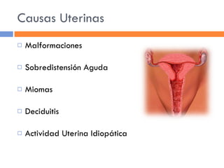 Causas Uterinas Malformaciones Sobredistensión Aguda Miomas Deciduitis Actividad Uterina Idiopática 