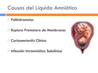 Causas del Líquido Amniótico Polihidramnios Ruptura Prematura de Membranas Corioamnionítis Clínica Infección Intramniótica Subclínica 
