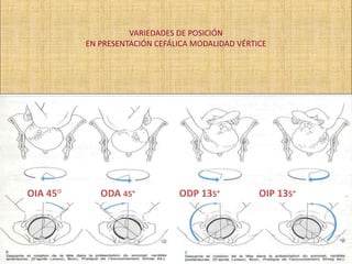 VARIEDADES DE POSICIÓN
EN PRESENTACIÓN CEFÁLICA MODALIDAD VÉRTICE
OIA 45° ODA 45° ODP 135° OIP 135°
 