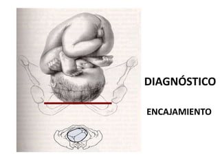 DIAGNÓSTICO
ENCAJAMIENTO
 