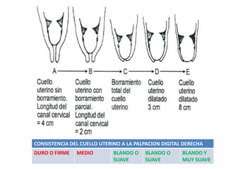CONSISTENCIA DEL CUELLO UTERINO A LA PALPACION DIGITAL DERECHA
DURO O FIRME MEDIO BLANDO O
SUAVE
BLANDO O
SUAVE
BLANDO Y
MUY SUAVE
 
