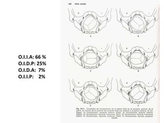 O.I.I.A: 66 %
O.I.D.P: 25%
O.I.D.A: 7%
O.I.I.P: 2%
 