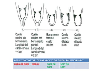 CONSISTENCY OF THE UTERINE NECK TO THE DIGITAL PALPATION RIGHT
HARD OR FIRM MEDIUJ SOFT OR
SOFT
SOFT OR
SOFT
 