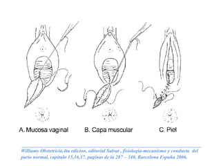 _________________________________________________________________________
Williams Obstetricia,4ta edicion, editorial Salvat , fisiologia-mecanismo y conducta del
parto normal, capitulo 15,16,17. paginas de la 287 – 340, Barcelona España 2006.
 