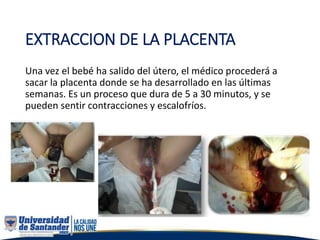 EXTRACCION DE LA PLACENTA
Una vez el bebé ha salido del útero, el médico procederá a
sacar la placenta donde se ha desarrollado en las últimas
semanas. Es un proceso que dura de 5 a 30 minutos, y se
pueden sentir contracciones y escalofríos.
 