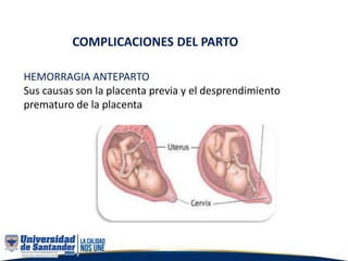 COMPLICACIONES DEL PARTO
HEMORRAGIA ANTEPARTO
Sus causas son la placenta previa y el desprendimiento
prematuro de la placenta
 