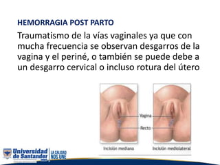 HEMORRAGIA POST PARTO
Traumatismo de la vías vaginales ya que con
mucha frecuencia se observan desgarros de la
vagina y el periné, o también se puede debe a
un desgarro cervical o incluso rotura del útero
 