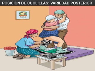 POSICIÓN DE CUCLILLAS: VARIEDAD POSTERIOR
 
