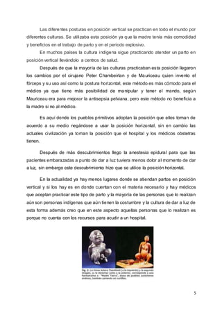 5
Las diferentes posturas en posición vertical se practican en todo el mundo por
diferentes culturas. Se utilizaba esta posición ya que la madre tenía más comodidad
y beneficios en el trabajo de parto y en el periodo explosivo.
En muchos países la cultura indígena sigue practicando atender un parto en
posición vertical llevándolo a centros de salud.
Después de que la mayoría de las culturas practicaban esta posición llegaron
los cambios por el cirujano Peter Chambeirlan y de Mauriceau quien invento el
fórceps y su uso así como la postura horizontal, este método es más cómodo para el
médico ya que tiene más posibilidad de manipular y tener el mando, según
Mauriceau era para mejorar la antisepsia pelviana, pero este método no beneficia a
la madre si no al médico.
Es aquí donde los pueblos primitivos adoptan la posición que ellos toman de
acuerdo a su medio negándose a usar la posición horizontal, sin en cambio las
actuales civilización ya toman la posición que el hospital y los médicos obstetras
tienen.
Después de más descubrimientos llego la anestesia epidural para que las
pacientes embarazadas a punto de dar a luz tuviera menos dolor al momento de dar
a luz, sin embargo este descubrimiento hizo que se utilice la posición horizontal.
En la actualidad ya hay menos lugares donde se atiendan partos en posición
vertical y si los hay es en donde cuentan con el materia necesario y hay médicos
que aceptan practicar este tipo de parto y la mayoría de las personas que lo realizan
aún son personas indígenas que aún tienen la costumbre y la cultura de dar a luz de
esta forma además creo que en este aspecto aquellas personas que lo realizan es
porque no cuenta con los recursos para acudir a un hospital.
 