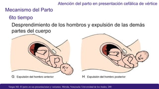 PARTO VERTICE (2).pptx manera de entender | PPTX