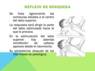 REFLEJO DE BÚSQUEDA
Se frota ligeramente las
comisuras labiales o el centro
del labio superior.
La respuesta será dirigir la parte
del labio estimulada hacia lo
que lo provoca.
En la estimulación del labio
superior hay además
retroflexión de cabeza;
aparece desde el nacimiento.
Su persistencia después de los
tres meses es patológica.
 