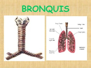 BRONQUIS 