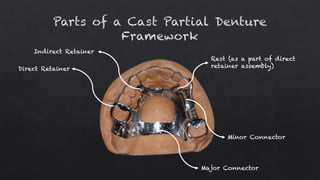 Removable Partial Denture Parts Removable Partial Denture Parts
