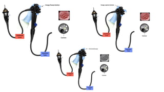 Parts of endoscope and disinfection principles.pptx