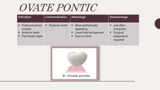 OVATE PONTIC
Indication Contraindication Advantage Disadvantage
 Fresh extraction
sockets
 Anterior teeth
 Flat broad ridges
 Posterior teeth  Most aesthetically
appealing
 Least food entrapment
 Easy to clean
 Just after
extraction
 Surgical
preparation
required
 