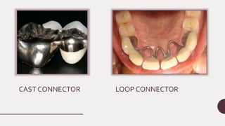 CAST CONNECTOR LOOP CONNECTOR
 