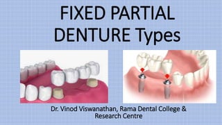 FIXED PARTIAL
DENTURE Types
Dr. Vinod Viswanathan, Rama Dental College &
Research Centre
 