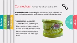 Minor Connector Rpd Types Parts of Removable Partial Denture by FARYAL SAEED ABDAL | PDF