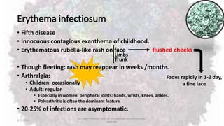 Erythema infectiosum
• Fifth disease
• Innocuous contagious exanthema of childhood.
• Erythematous rubella-like rash on face flushed cheeks
• Though fleeting: rash may reappear in weeks /months.
• Arthralgia:
• Children: occasionally
• Adult: regular
• Especially in women: peripheral joints: hands, wrists, knees, ankles.
• Polyarthritis is often the dominant feature
• 20-25% of infections are asymptomatic.
2/19/2016
Dr. Kaveh Haratian, Dept. of Microbiology and Immunology,
ABZUMS
21
Limbs
Trunk
Fades rapidly in 1-2 day,
a fine lace
 
