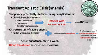 Transient Aplastic Crisis(anemia)
• Temporary, potentially life-threatening complication in:
• Chronic hemolytic anemia:
• Sickle cell anemia
• Thalassemia
• Hereditary spherocytosis
• Characteristics of severe anemia:
• Pallor, weakness, lethargy
• Recovery occurs spontaneously in a week.
• Blood transfusion is sometimes lifesaving.
2/19/2016
Dr. Kaveh Haratian, Dept. of Microbiology and Immunology,
ABZUMS
23
Infected with
Parvovirus B19
Usually norash
Sudden drop in hemoglobin
Total disappearance of
erythrocytes precursors
from bone marrow
Reticulocytes from the
blood
 