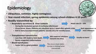 Epidemiology
• Ubiquitous, common, highly contagious.
• Year-round infection, spring epidemics among school-children 4-10 years.
• Readily transmitted by:
• Respiratory secretions & close contacts
• During the incubation period of erythema infectiosum
• Chron.hemo. Anem. Patients are infectious up to 1 week after aplastic crisis.
• B19 in immunocompromised patients: excrete virus for months/years.
• Transplacental transmission:
• Less than 10% leads to fetal death.
• Rarely congenital malformations
• Blood transfusion:
• Factor VIII is a great problem
2/19/2016
Dr. Kaveh Haratian, Dept. of Microbiology and Immunology,
ABZUMS
28
Attack rate:25 – 50%
Rash appearance: no
more infectious
30% maternal infections
transmit into fetus
Usually no harm!
The virus is heat stable:
survive in clotting factor
concentrate
 
