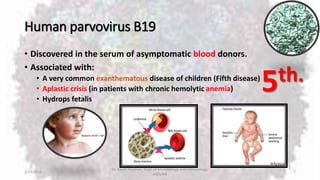 Human parvovirus B19
• Discovered in the serum of asymptomatic blood donors.
• Associated with:
• A very common exanthematous disease of children (Fifth disease)
• Aplastic crisis (in patients with chronic hemolytic anemia)
• Hydrops fetalis
2/19/2016
Dr. Kaveh Haratian, Dept. of Microbiology and Immunology,
ABZUMS
7
5th.
 