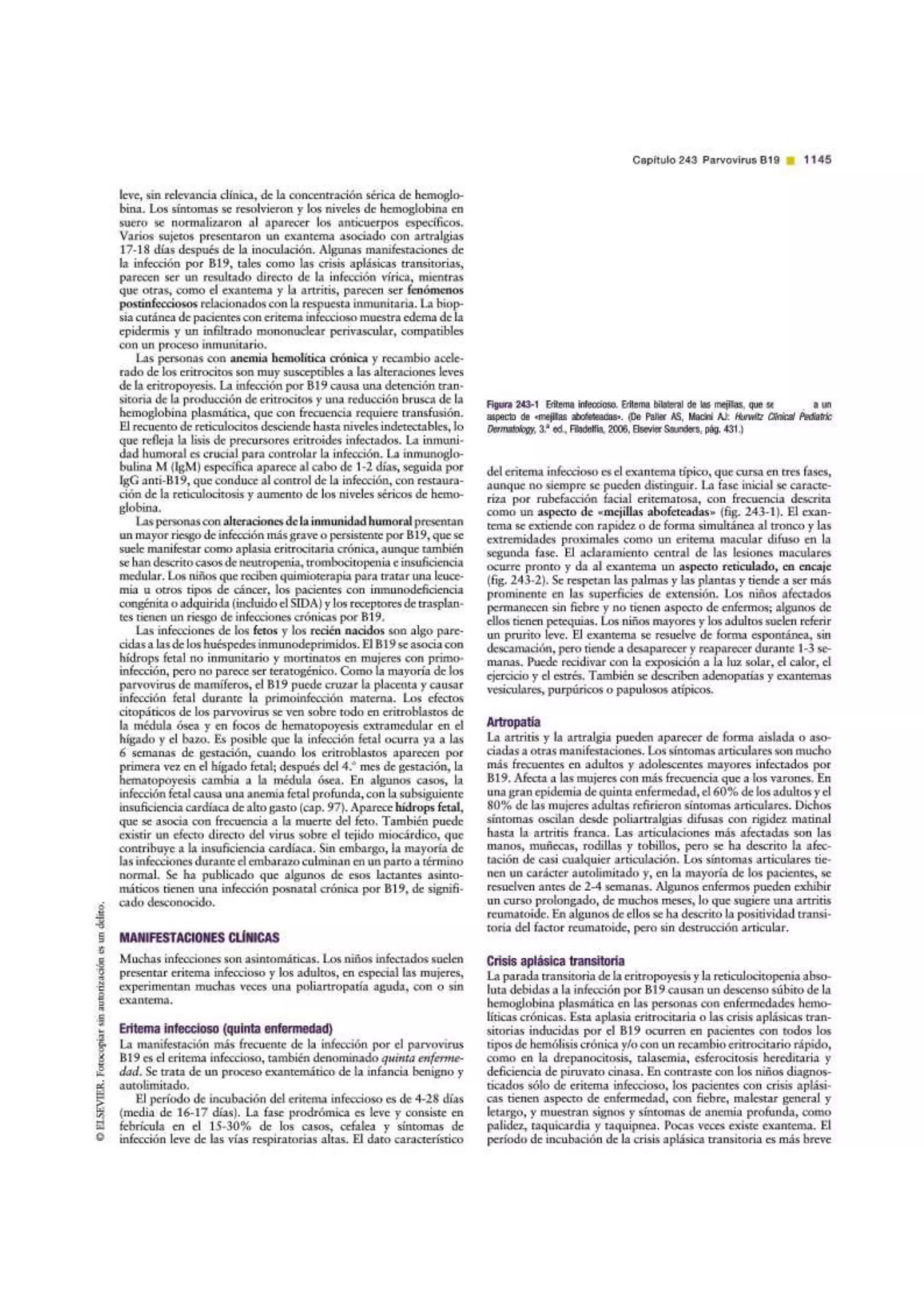 Parvovirus B19 | Tratado de Pediatria de Nelson 19 Ed.