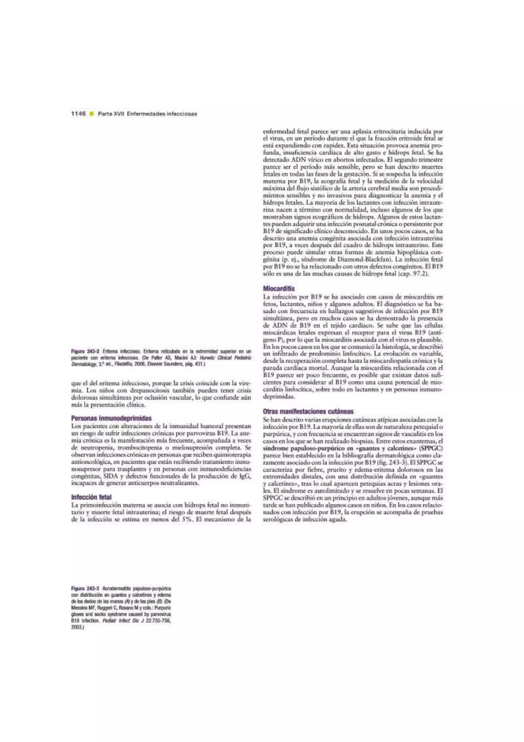 Parvovirus B19 | Tratado de Pediatria de Nelson 19 Ed.