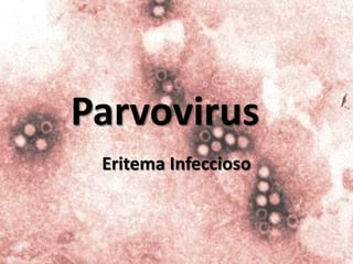Parvovirus Eritema Infeccioso  