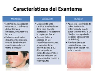Características del Exantema 