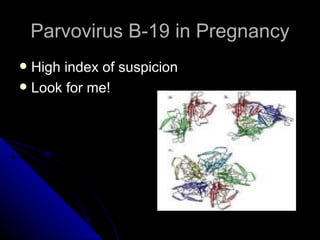 Parvovirus B-19 in Pregnancy High index of suspicion Look for me! 