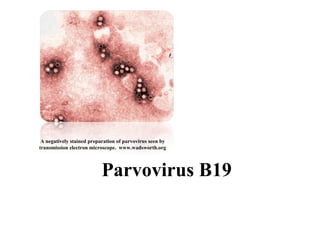 Parvovirus B19
A negatively stained preparation of parvovirus seen by
transmission electron microscope. www.wadsworth.org