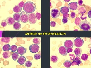 B19 Inside Inside the Cell: Parvovirus B19’s Cytological Signatures | PDF