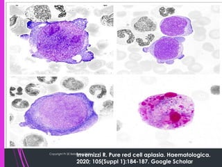 B19 Inside Inside the Cell: Parvovirus B19’s Cytological Signatures | PDF