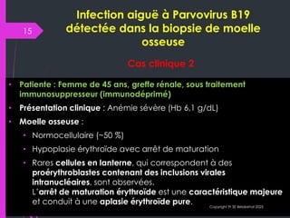 B19 Inside Inside the Cell: Parvovirus B19’s Cytological Signatures | PDF