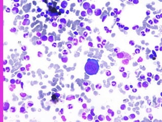 B19 Inside Inside the Cell: Parvovirus B19’s Cytological Signatures | PDF