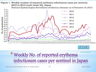 *Weekly No. of reported erythema
infectiosum cases per sentinel in Japan
www.niid.go.jp
08/10/2018Parvovirus 3B19 infection Prof. Dr. Saad S AlAni 17
 