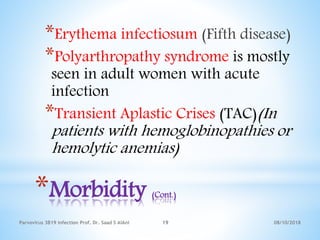 08/10/2018Parvovirus 3B19 infection Prof. Dr. Saad S AlAni 19
*Morbidity (Cont.)
*Erythema infectiosum (Fifth disease)
*Polyarthropathy syndrome is mostly
seen in adult women with acute
infection
*Transient Aplastic Crises (TAC)(In
patients with hemoglobinopathies or
hemolytic anemias)
 