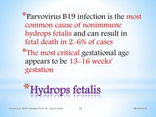 08/10/2018Parvovirus 3B19 infection Prof. Dr. Saad S AlAni 24
*Hydrops fetalis
*Parvovirus B19 infection is the most
common cause of nonimmune
hydrops fetalis and can result in
fetal death in 2-6% of cases
*The most critical gestational age
appears to be 13-16 weeks'
gestation
 