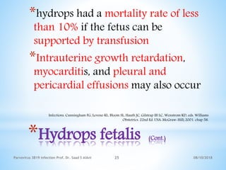 08/10/2018Parvovirus 3B19 infection Prof. Dr. Saad S AlAni 25
*Hydrops fetalis (Cont.)
*hydrops had a mortality rate of less
than 10% if the fetus can be
supported by transfusion
*Intrauterine growth retardation,
myocarditis, and pleural and
pericardial effusions may also occur
Infections. Cunningham FG, Leveno KL, Bloom SL, Hauth JC, Gilstrap III LC, Wenstrom KD, eds. Williams
Obstetrics. 22nd Ed. USA: McGraw-Hill; 2001. chap 58.
 