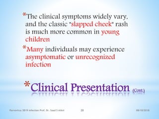 08/10/2018Parvovirus 3B19 infection Prof. Dr. Saad S AlAni 28
*Clinical Presentation (Cont.)
*The clinical symptoms widely vary,
and the classic "slapped cheek" rash
is much more common in young
children
*Many individuals may experience
asymptomatic or unrecognized
infection
 