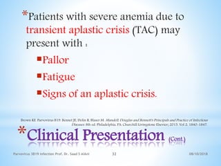 08/10/2018Parvovirus 3B19 infection Prof. Dr. Saad S AlAni 32
*Clinical Presentation (Cont.)
*Patients with severe anemia due to
transient aplastic crisis (TAC) may
present with :
Pallor
Fatigue
Signs of an aplastic crisis.
Brown KE. Parvovirus B19. Bennet JE, Dolin R, Blaser M. Mandell, Douglas and Bennett's Principals and Practice of Infectious
Diseases. 8th ed. Philadelphia, PA: Churchill Livingstone Elsevier; 2015. Vol 2: 1840-1847.
 