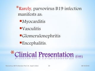08/10/2018Parvovirus 3B19 infection Prof. Dr. Saad S AlAni 34
*Clinical Presentation (Cont.)
*Rarely, parvovirus B19 infection
manifests as:
Myocarditis
Vasculitis
Glomerulonephritis
Encephalitis.
 