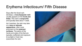 Extensor Rash Parvovirus Infection.presentation for pediatric patients | PPTX