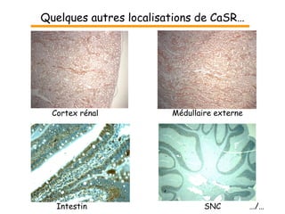 Quelques autres localisations de CaSR … Cortex rénal Médullaire externe Intestin SNC  …/… 