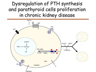 Dysregulation of PTH synthesis and parathyroid cells proliferation in chronic kidney disease 