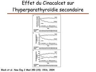 Effet du Cinacalcet sur l ’ hyperparathyroïdie secondaire Block et al. New Eng J Med 350 (15): 1516, 2004 