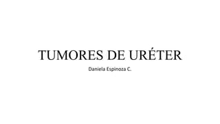 TUMORES DE URÉTER
Daniela Espinoza C.
 