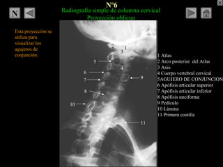 Nº6
Radiografía simple de columna cervical
Proyección oblicua
1 Atlas
2 Arco posterior del Atlas
3 Axis
4 Cuerpo vertebral...