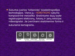 Sukurtos įvairios “kirlianinės” bioelektrografijos
technologijos. Viena jų – KOROTKOVO sukurta
kompiuterinė metodika: išretintame dujų lauke
registruojami elektronų, fotonų ir jonų emisijos
videosignalai. Jie įvertinami skaitmenine forma ir
sukuriama kartograma.
.
 